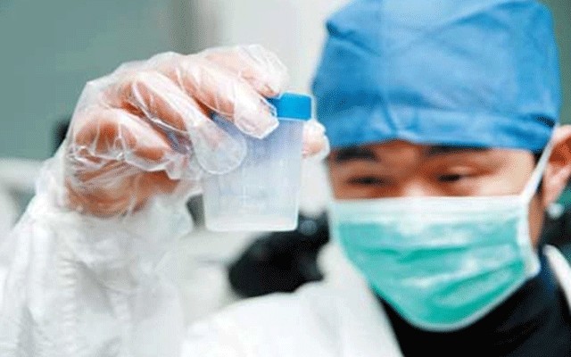 精液檢查